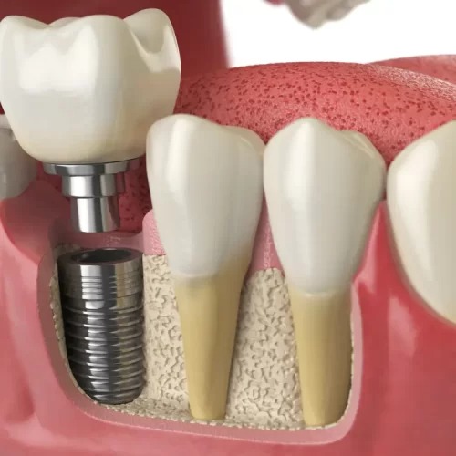 The Services Offered By A Leading Dental Clinic